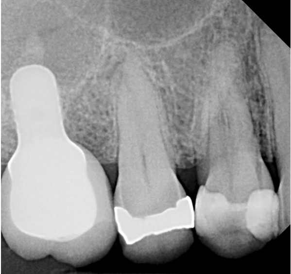 Online Dental CE Webinars And Events | Article - null | DentalXP