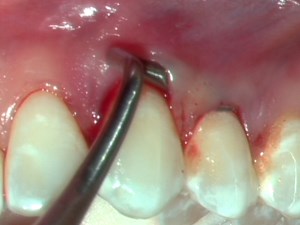 Online Dental CE Webinars And Events | Video - null | DentalXP