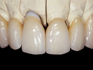 Online Dental CE Webinars And Events | Video - null | DentalXP